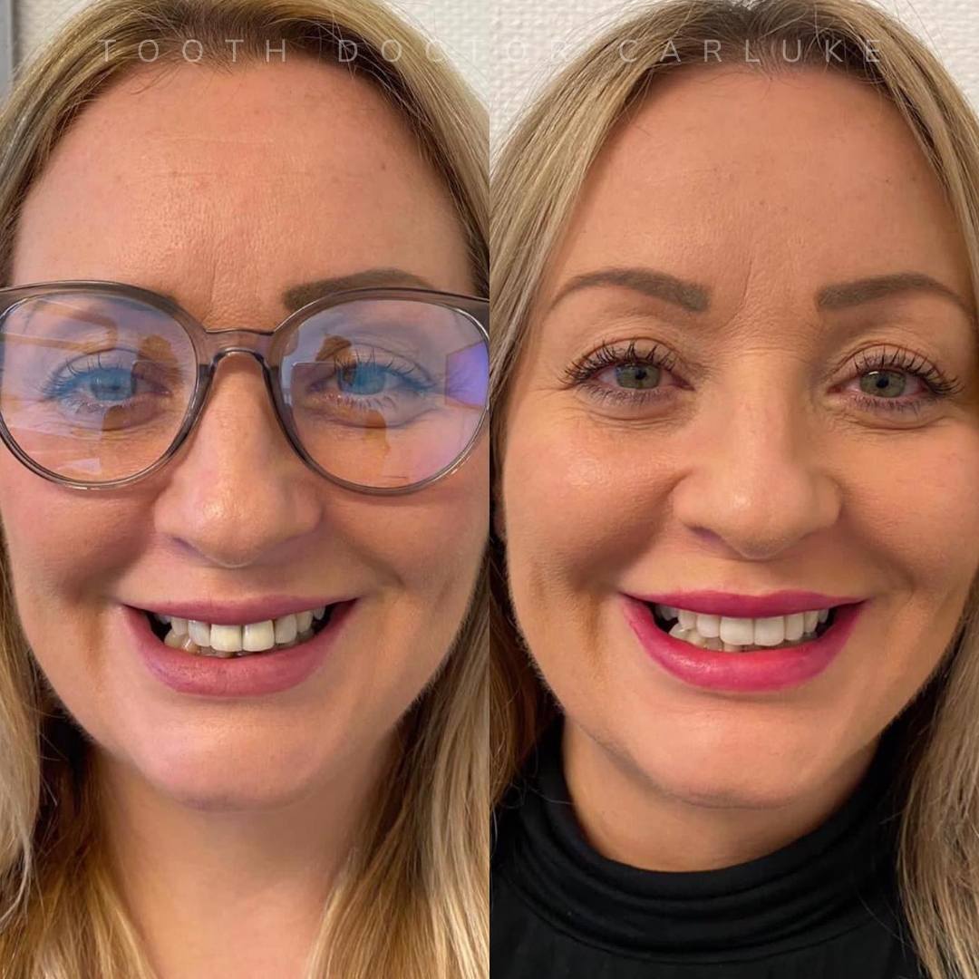 Tooth Doctor | Tooth Doctor Carluke Before and after treatment