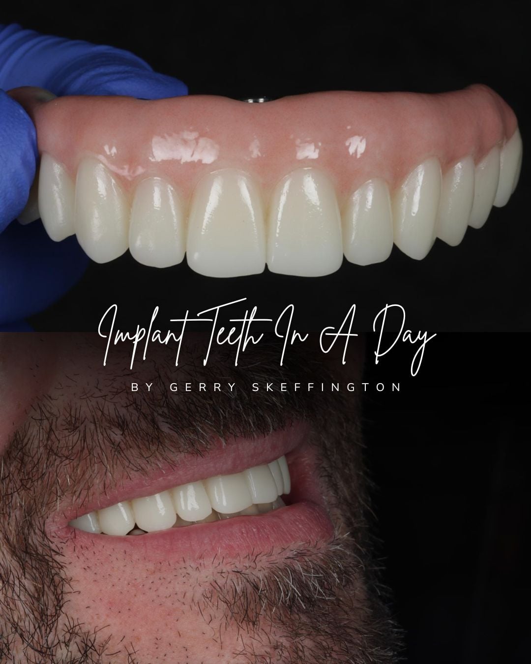 Tooth Doctor | Tooth Doctor Carluke Before and after treatment