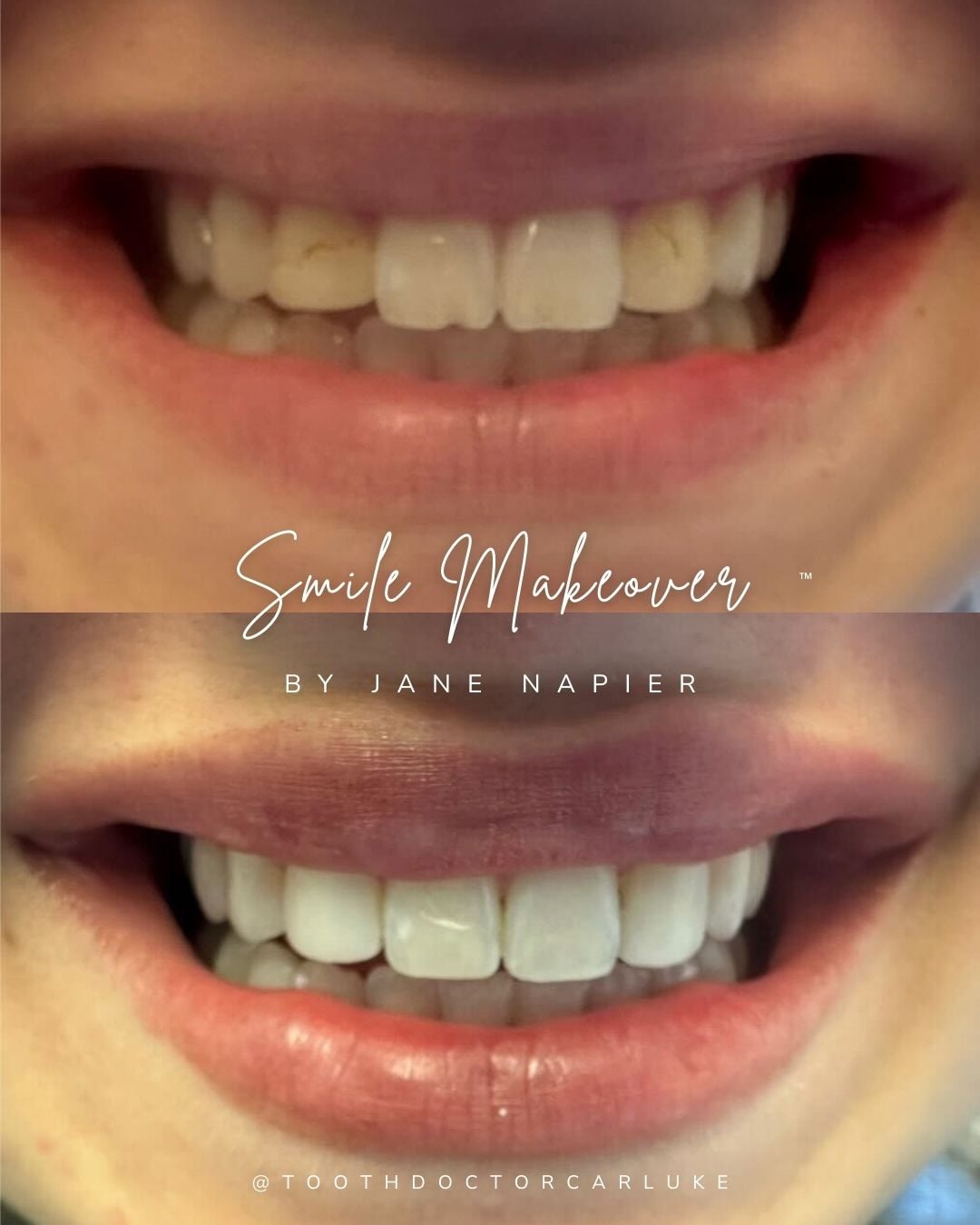 Tooth Doctor | Tooth Doctor Carluke Before and after treatment