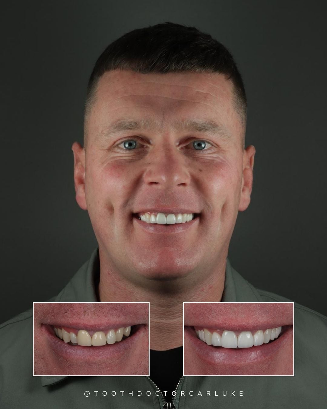 Tooth Doctor | Tooth Doctor Carluke Before and after treatment