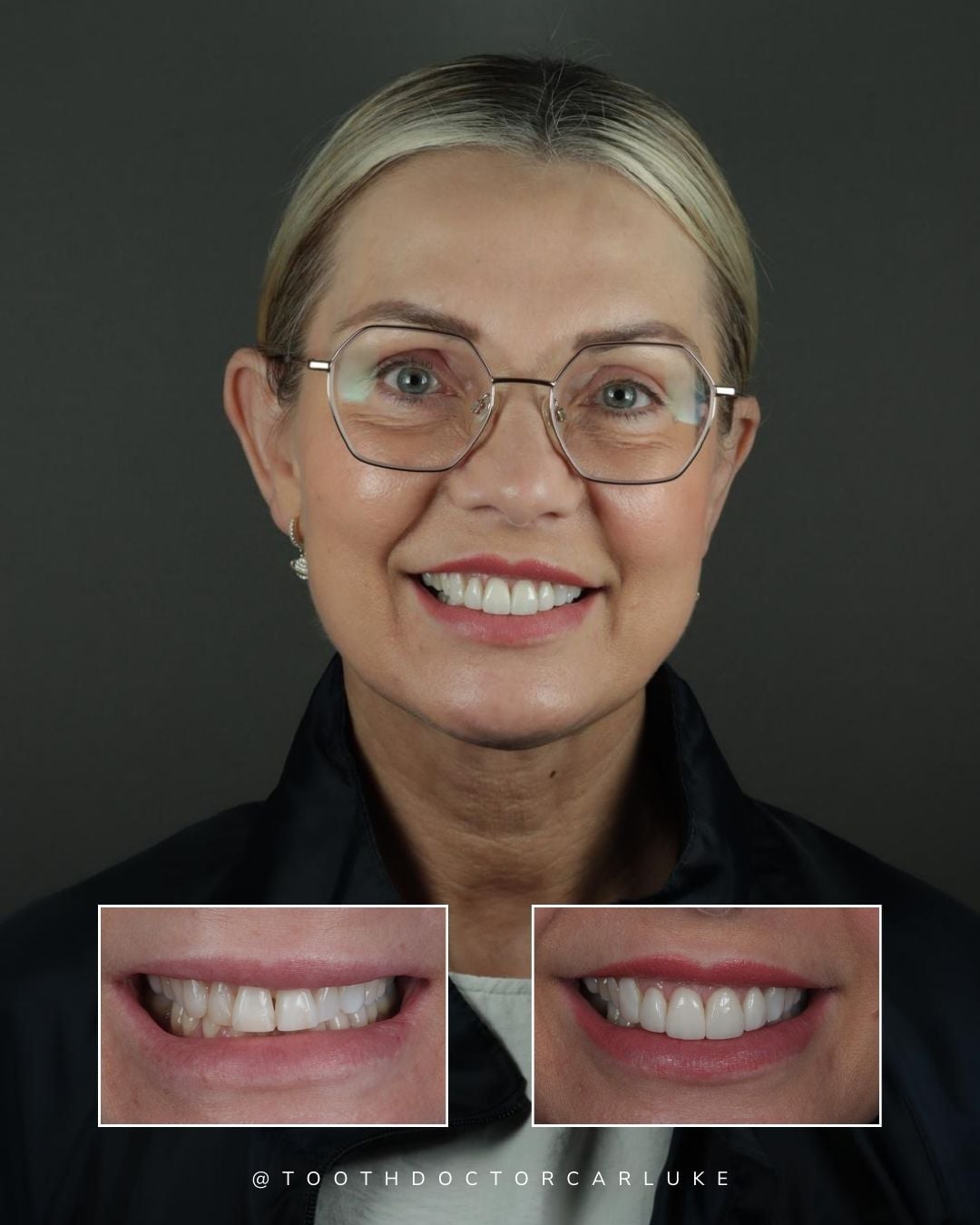 Tooth Doctor | Tooth Doctor Carluke Before and after treatment